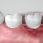 Gums Healthy