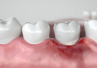 Gums Healthy