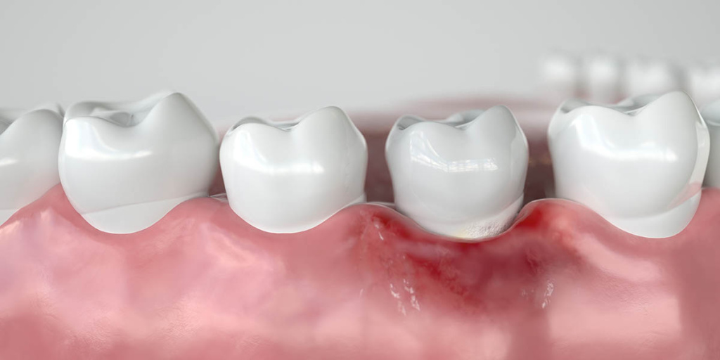Gums Healthy